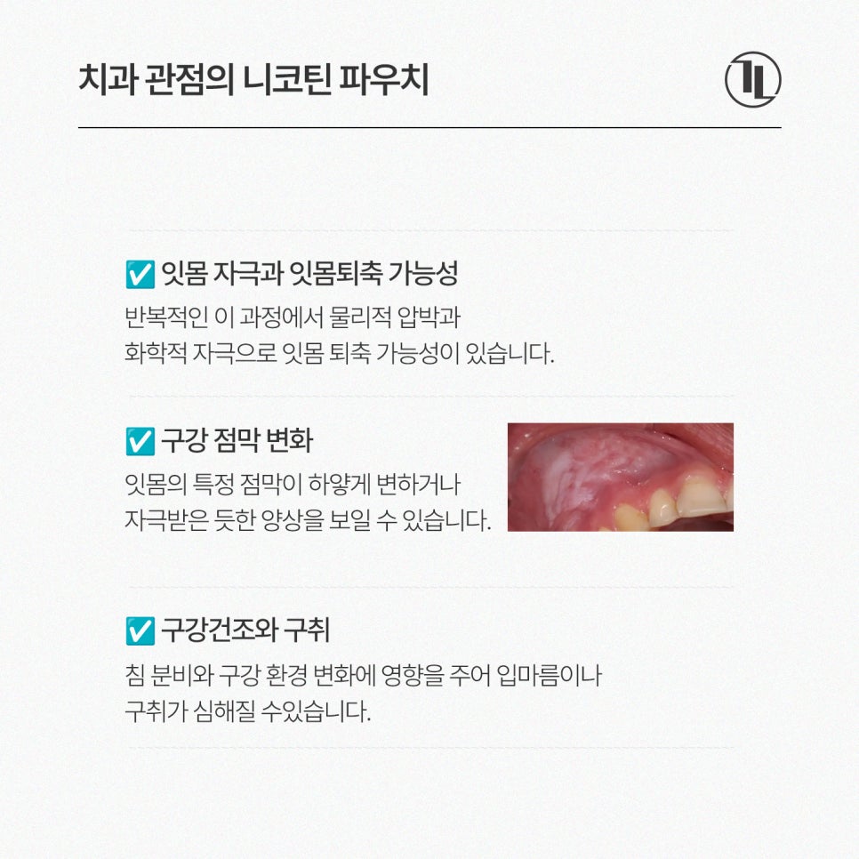 니코틴 파우치, 사용 전 알아야 할 주의 사항 / 잇몸담배 부작용과 잇몸 건강 / 강남레옹치과 관련 이미지 5