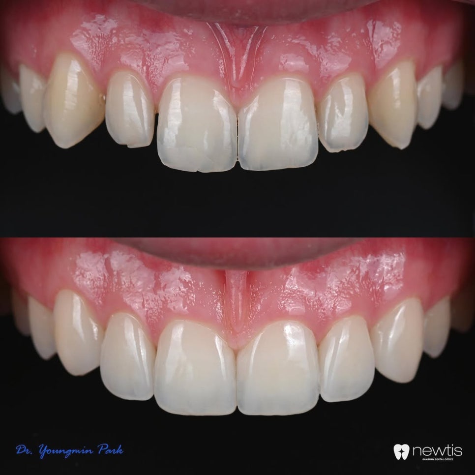 박영민 원장님의 Aesthetic Dentistry A to Z 세미나📝 관련 이미지 2