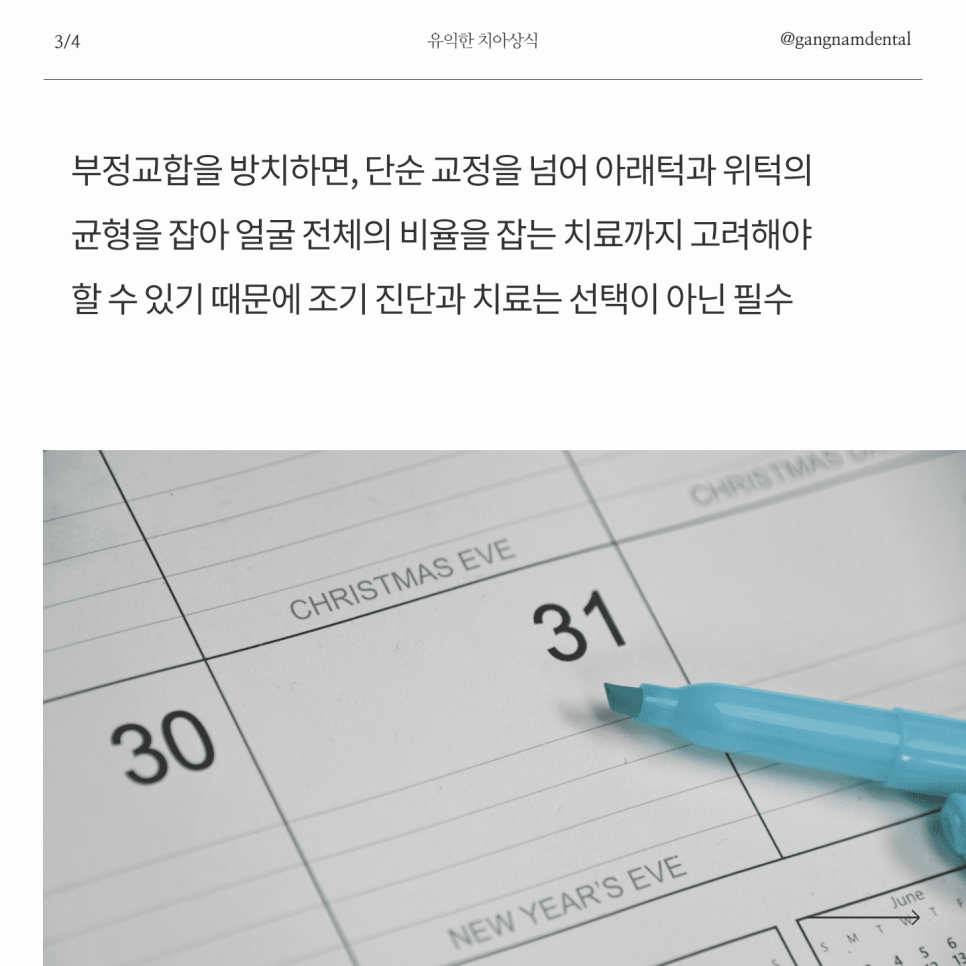 소아 청소년 치아교정의 필요성과 관련 이미지 4