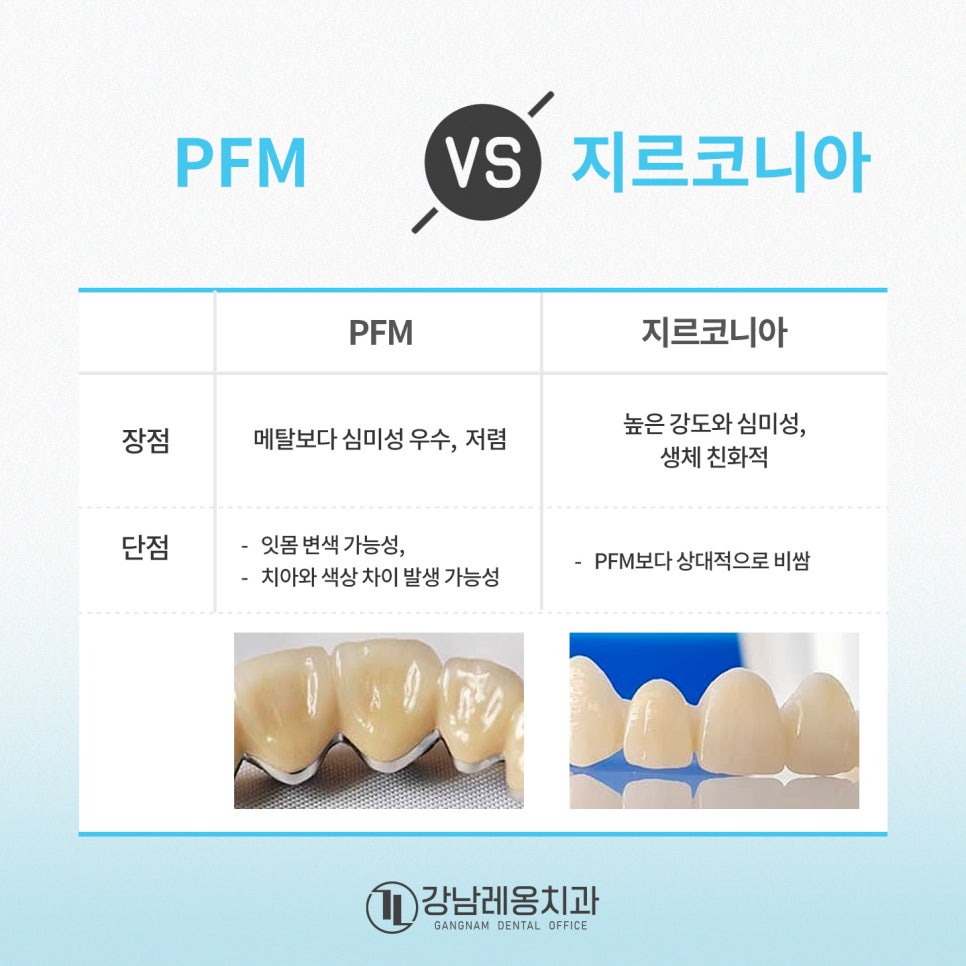 강남레옹치과 임플란트 지르코니아 건강보험 확대 총정리! 적용 대상부터 조건까지🔎 관련 이미지 3