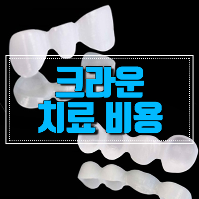 크라운치료 비용, 각자 특징과 장단점이 달라요. 관련 이미지 1