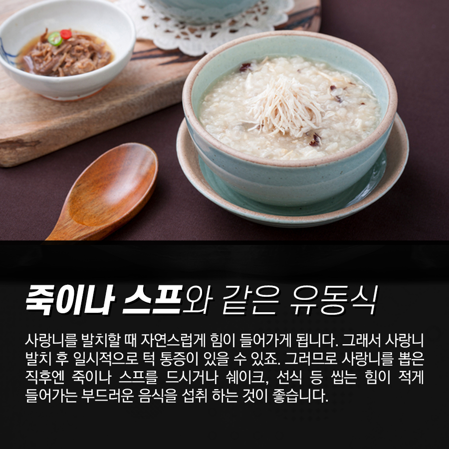 사랑니 발치 후 식사 요령, 언제부터 어떤 음식을 먹어야 될까? 관련 이미지 3