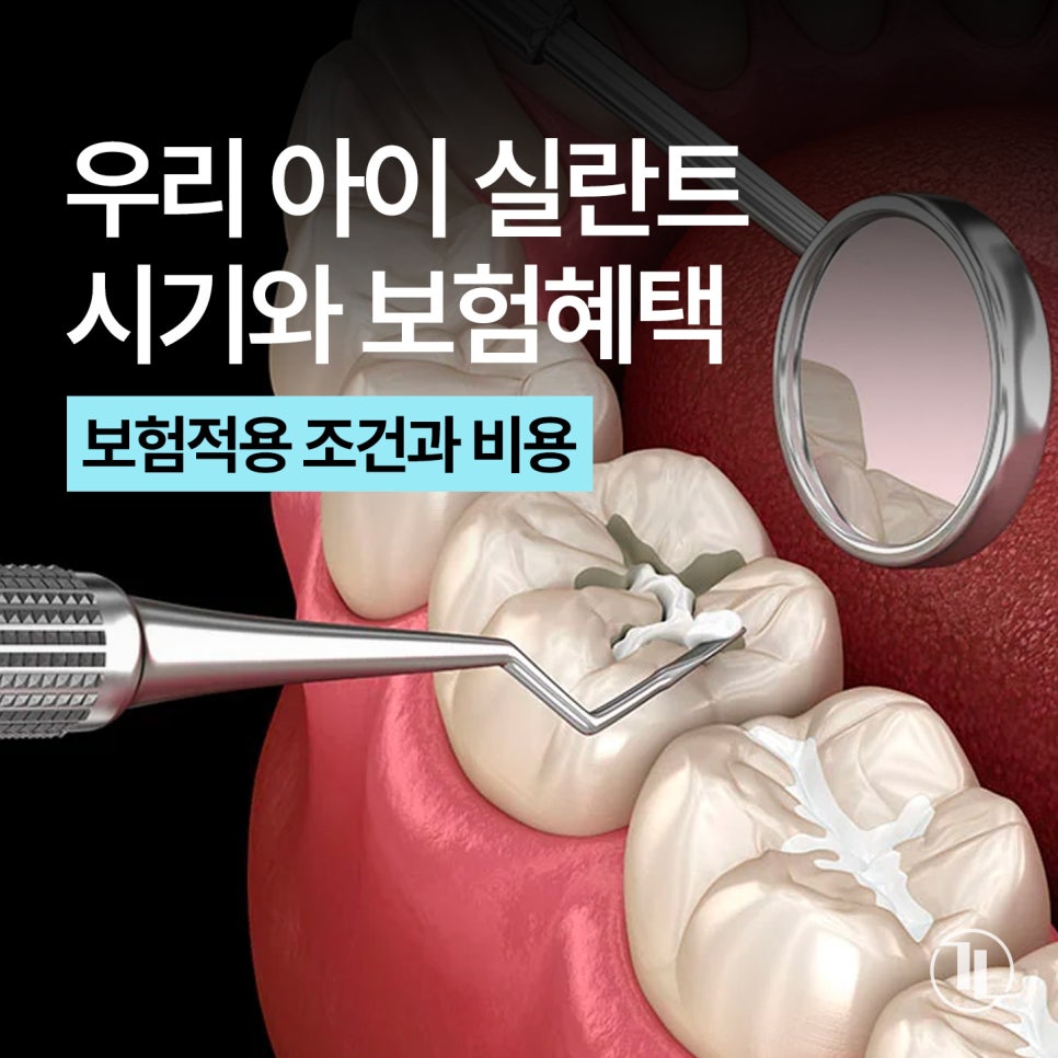 어린이 실란트, 언제 해야 할까? 시기와 보험 혜택까지 쉽게 설명 / 강남레옹치과 관련 이미지 1