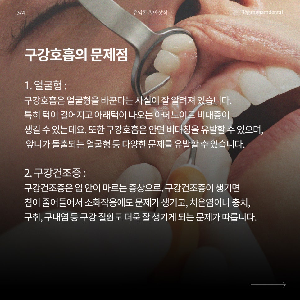 부정교합을 유발하는 생활습관이 있다고? / 부정교합으로 인한 턱관절 장애까지? / 치아교정치과 / 강남레옹치과 관련 이미지 4