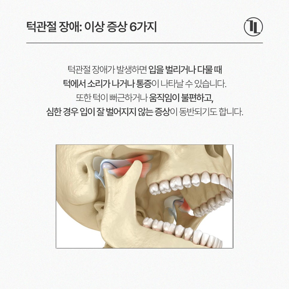 턱이 아프고 소리가 난다면? 턱관절 이상 증상과 원인, 치료까지 / 턱관절 진료 강남레옹치과 관련 이미지 2