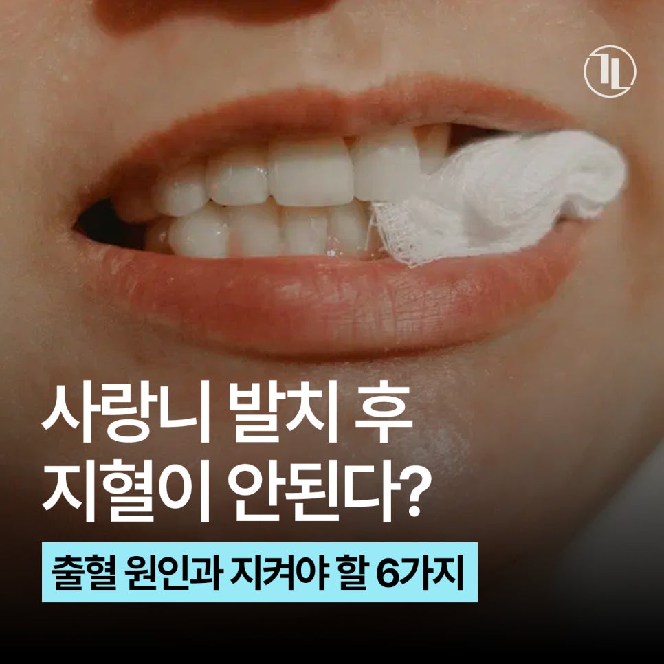 사랑니 발치 지혈이 안된다? / 지혈을 위한 6가지 / 지혈제란? / 강남레옹치과 관련 이미지 1