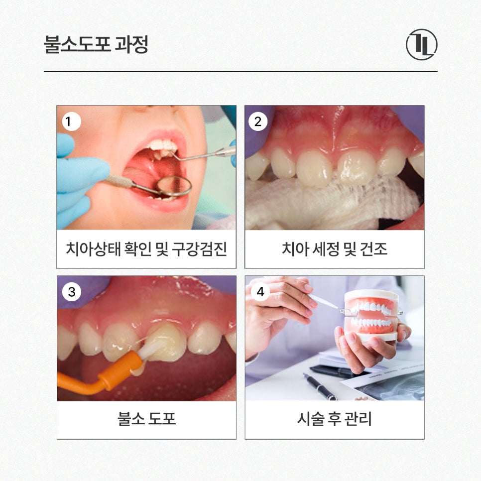 아기 불소도포 시기, 주기, 안정성 총정리 한눈에 보기🧐 / 강남레옹치과 관련 이미지 5