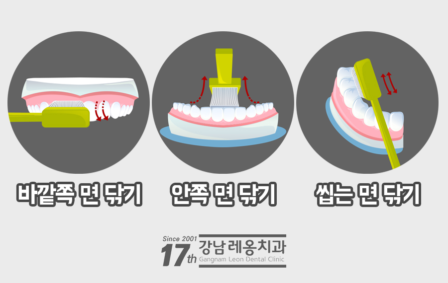 올바른 잇솔질이 왜 중요한지 예방중심 강남역치과의 설명 관련 이미지 8