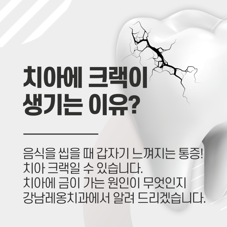 치아크랙? 치아에 금이 가는 이유, 균열 생겼을 때 증상 관련 이미지 1