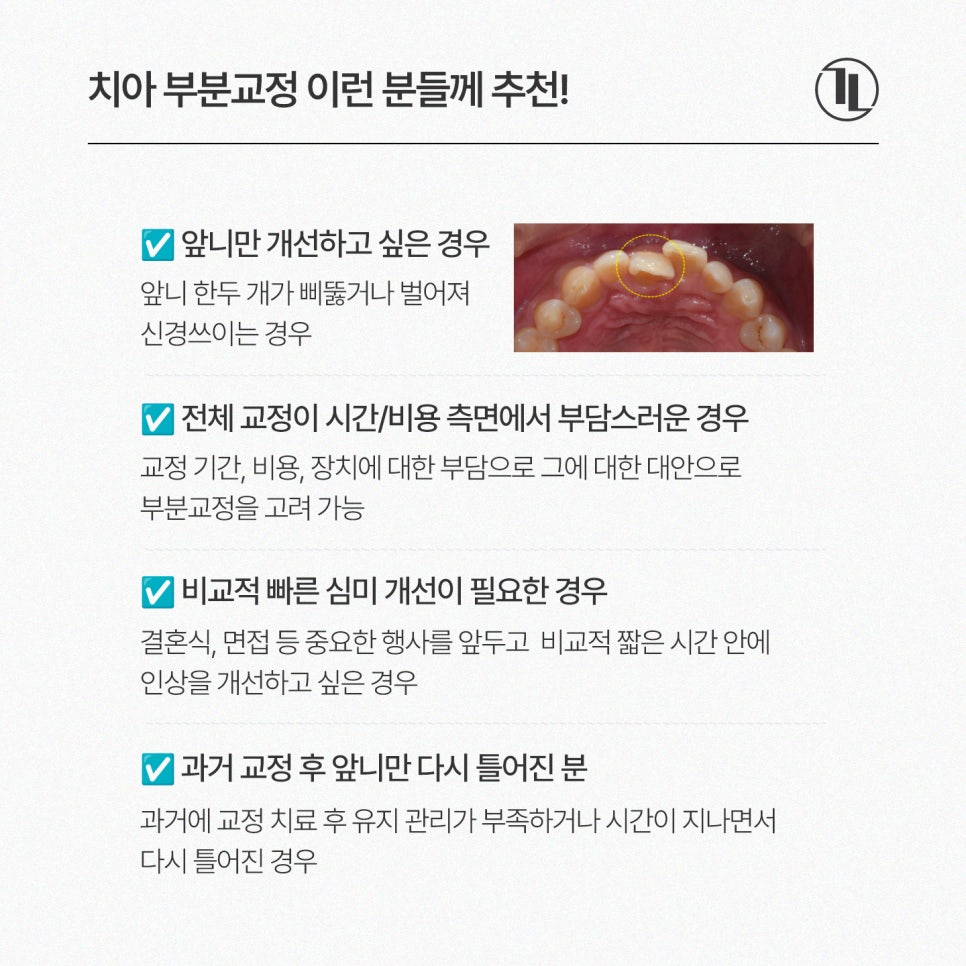 앞니 부분교정 가능여부와 기간 현실 정리! / 강남레옹치과 관련 이미지 4