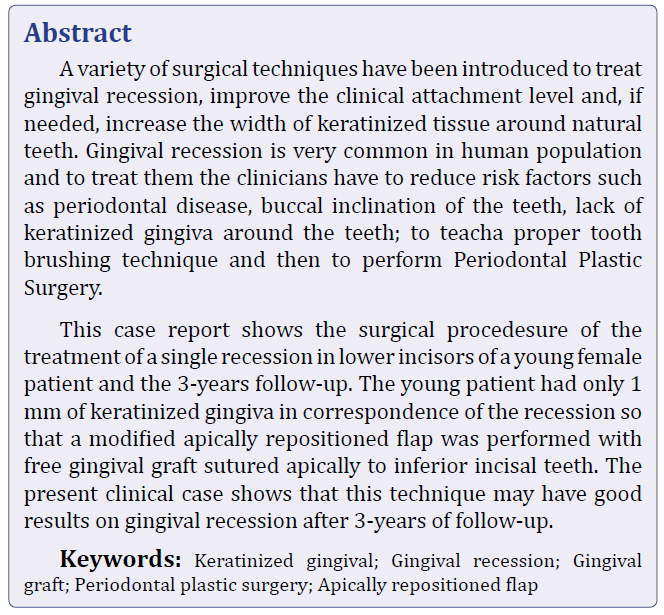 박영민 원장님의 논문! 치은이식 후 자연치아 주위 잇몸퇴축 감소에 관한 연구 관련 이미지 2