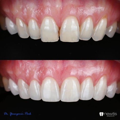 Aesthetic Dentistry A to Z, 박영민 원장님의 앞니치료 세미나 스케치🎤 관련 이미지 8