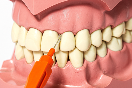 임산부 출산 후 치아관리, 잇몸관리 하는 방법 / 강남레옹치과 관련 이미지 4