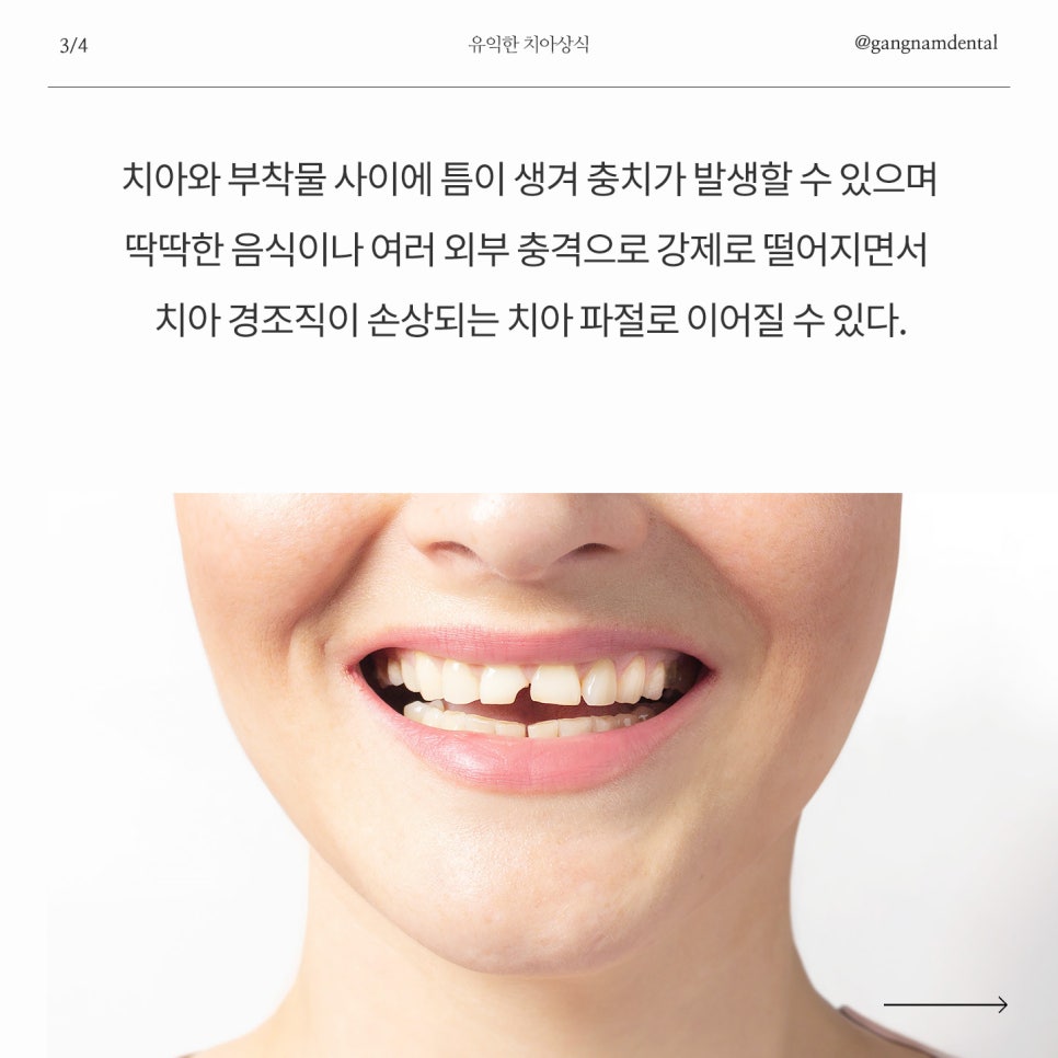 반짝반짝한 치아 ✨ 관련 이미지 6