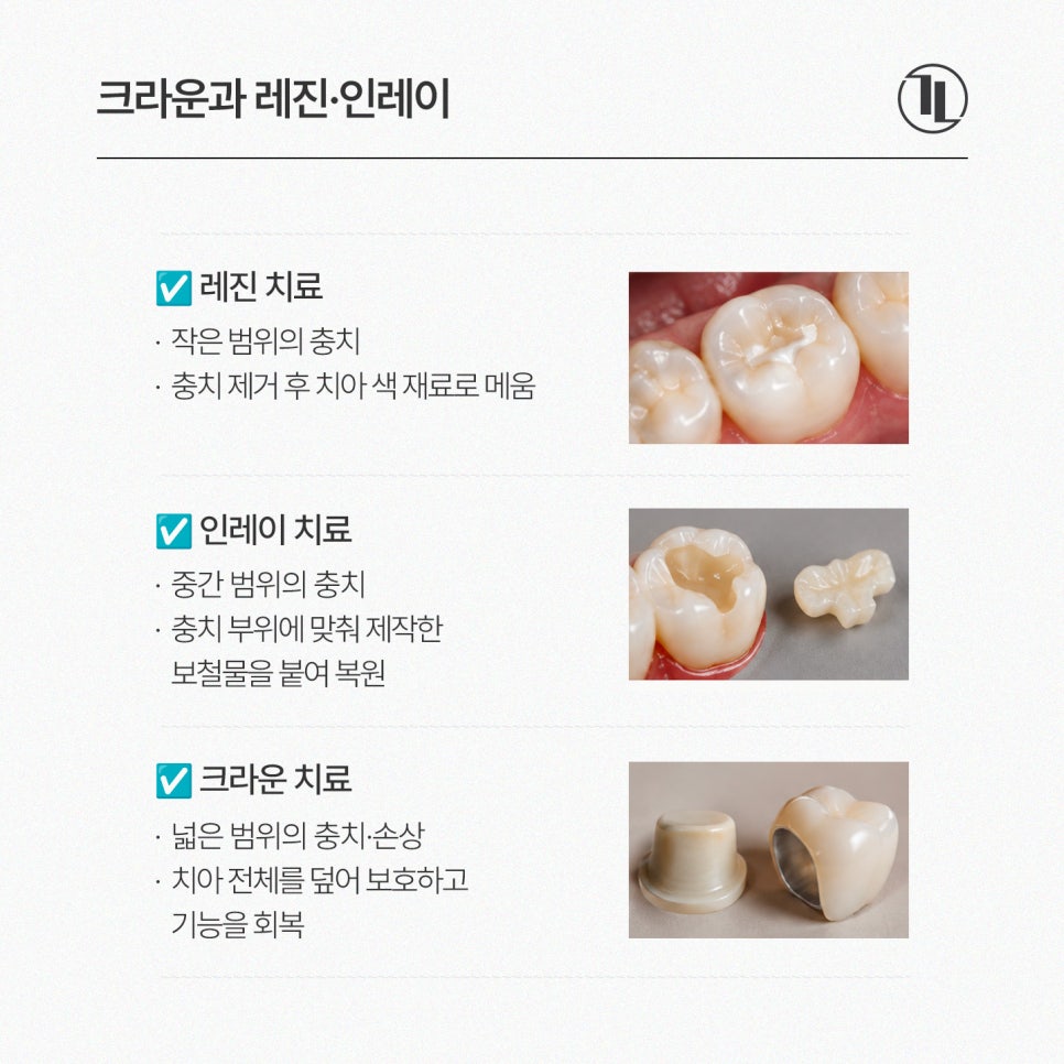 크라운 치료 가이드 / 충치&middot;신경치료 후 크라운과 가격&보험 / 강남레옹치과 관련 이미지 9