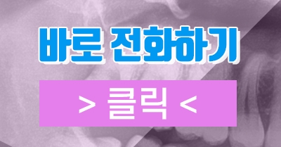 강남 레옹치과 뿌리 휘어진 사랑니 발치, 2개 한꺼번에 뽑은 사례 관련 이미지 5