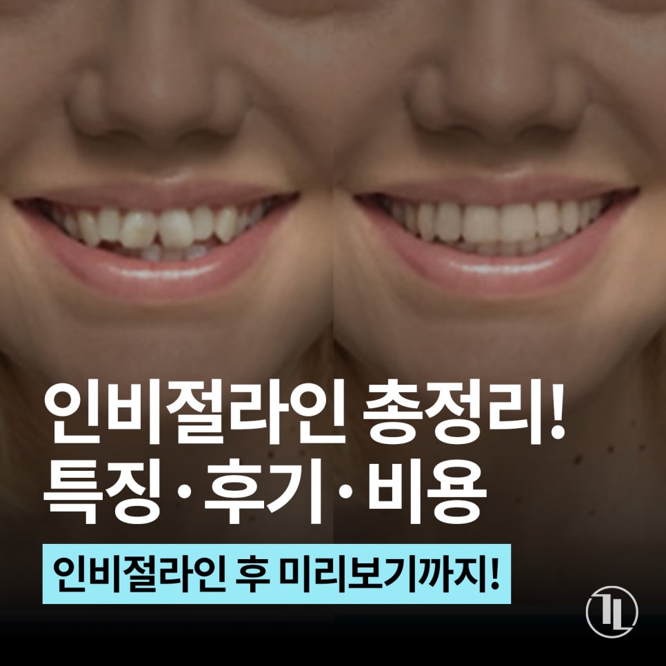 인비절라인 특징&middot;후기&middot;가격 총정리! 투명교정 완벽 가이드 / 강남역 교정치과 강남레옹치과 관련 이미지 1