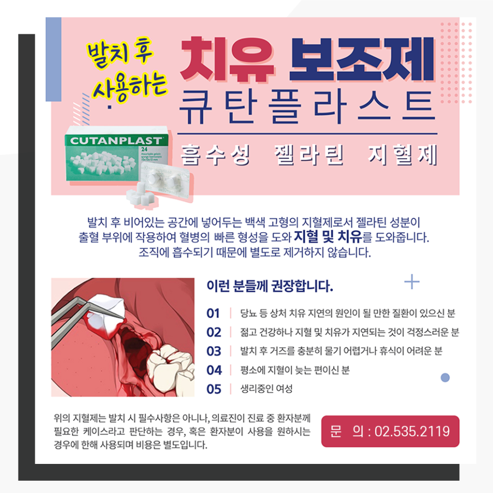사랑니 발치 지혈제 큐탄플라스트 스폰지 관련 이미지 1