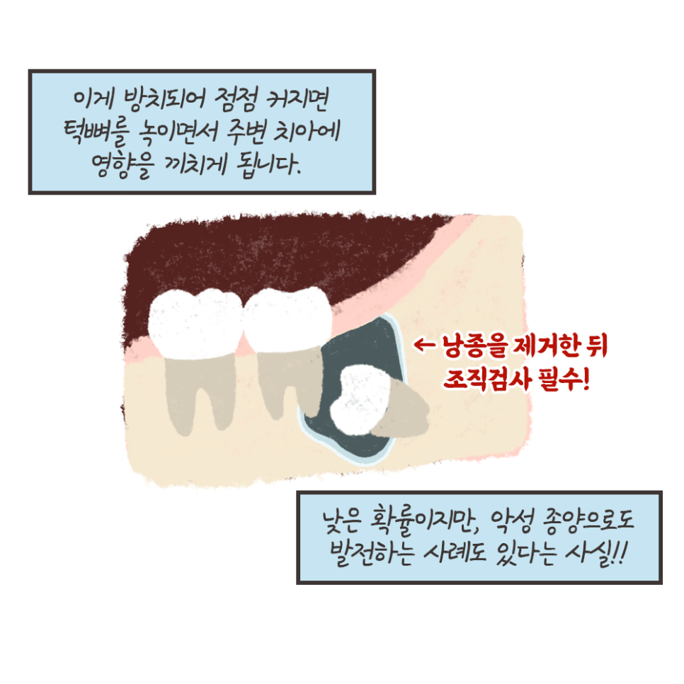 사랑니 발치 이유!! 최악의 경우 이렇게까지 된다..? (냐폴레옹툰 7화) 관련 이미지 11