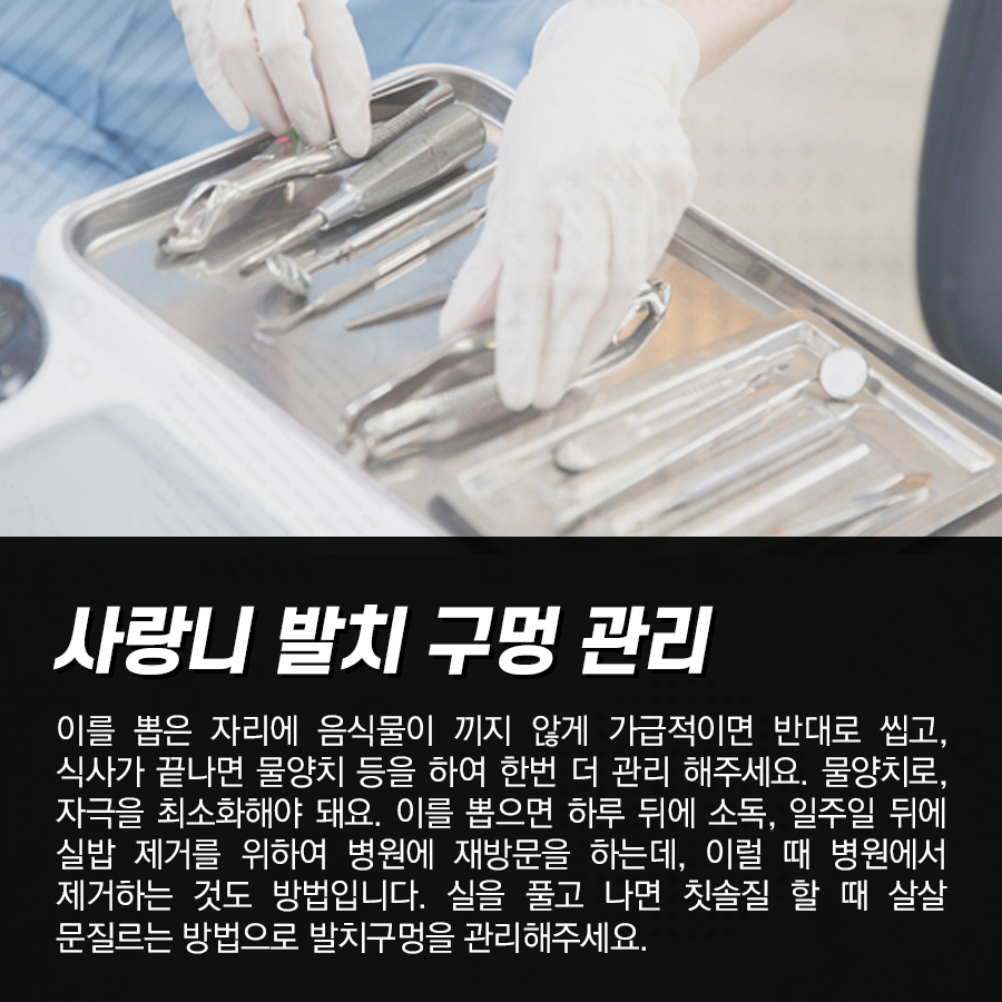 사랑니 발치 후 구멍 제대로 치유되려면 음식물 안 끼게 관리! 관련 이미지 3
