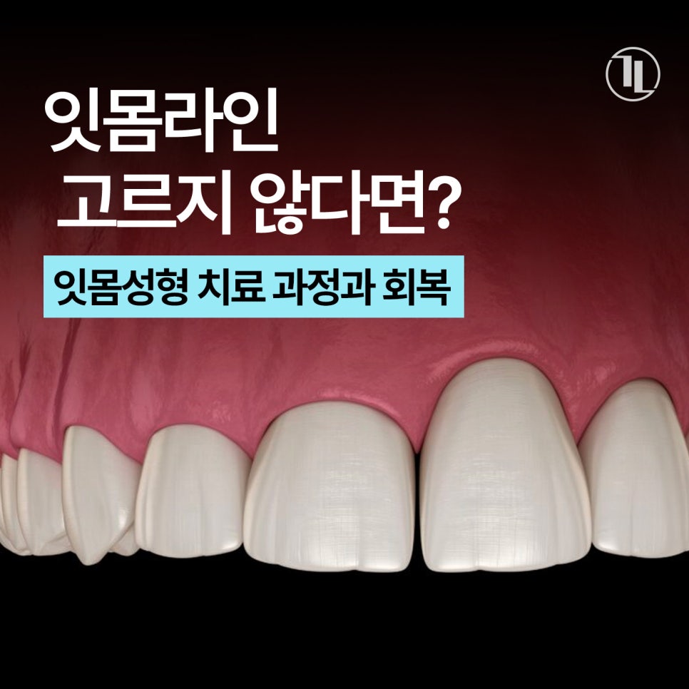 앞니 잇몸 라인이 들쭉날쭉하다면? 잇몸성형 치료 과정부터 회복 기간&middot;주의 사항까지 / 강남레옹치과 관련 이미지 1