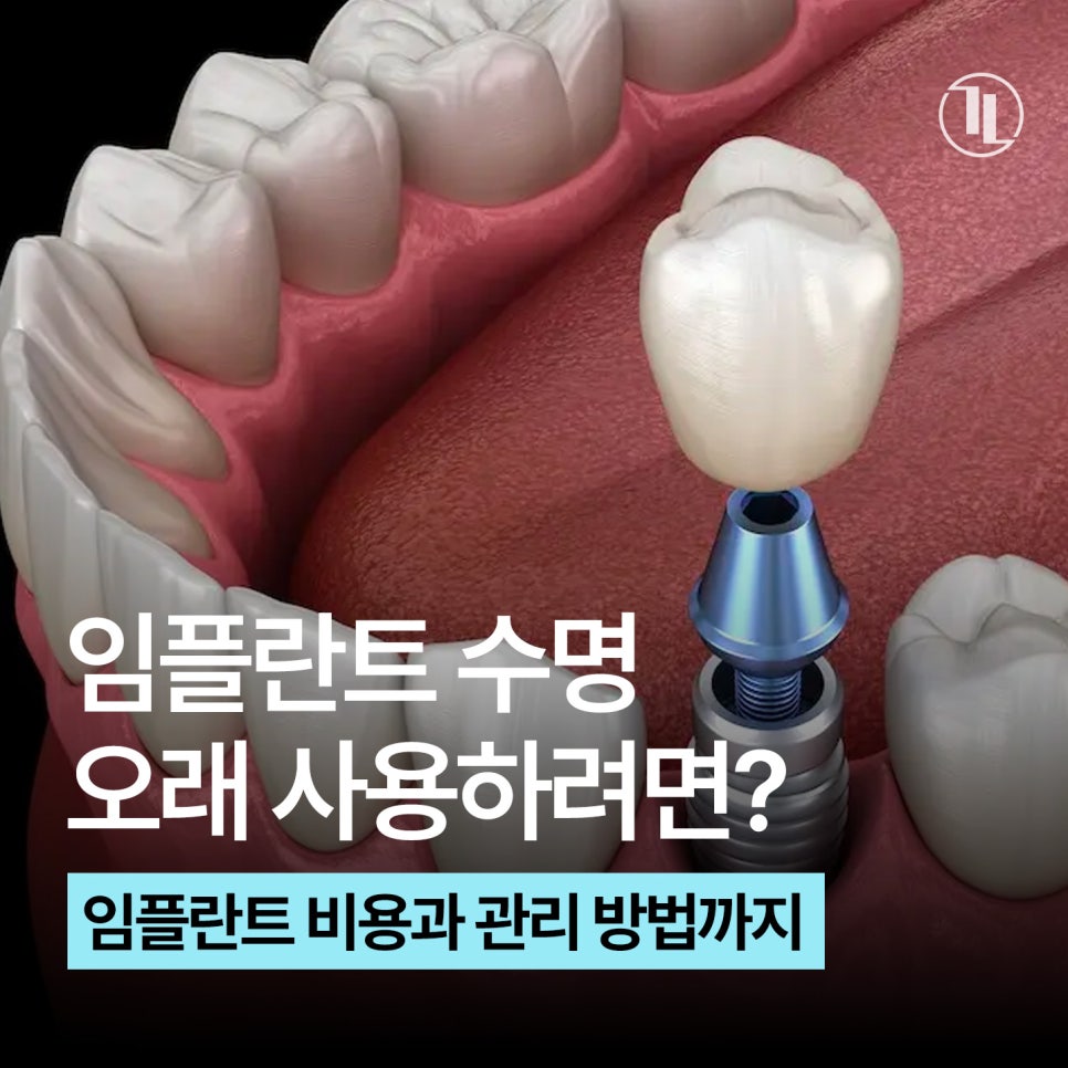 임플란트 수명은 얼마나 될까? 비용부터 관리 방법까지 / 강남레옹치과 관련 이미지 1
