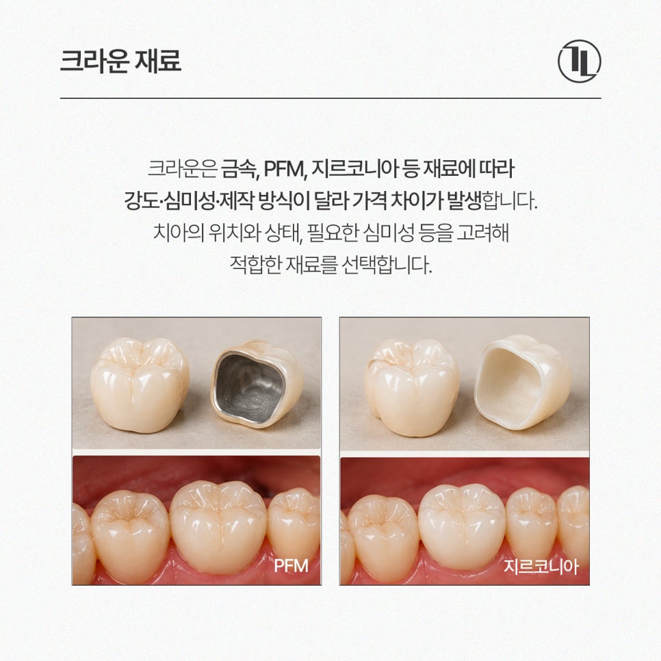 크라운 치료 가이드 / 충치&middot;신경치료 후 크라운과 가격&보험 / 강남레옹치과 관련 이미지 11