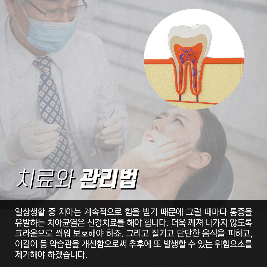 금이 간 치아, 균열이 생겼을 때 대처법! 관련 이미지 4