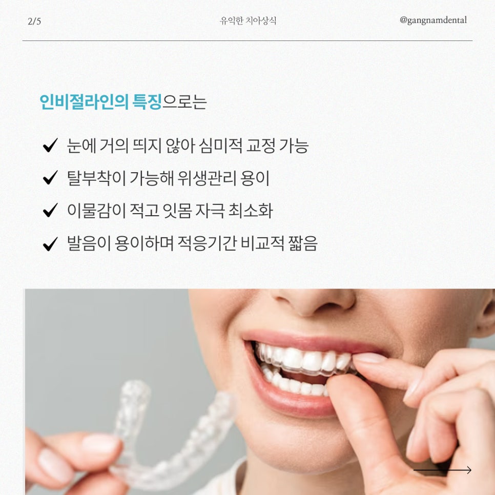 강남역치과, 여름방학 앞두고 우리 아이 투명교정 인비절라인에 대해 고민하고 계신다면? 관련 이미지 3