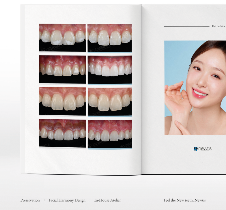 박영민 원장님의 뉴티스 앞니치료 세미나 스케치 in LA, USA📑 관련 이미지 9