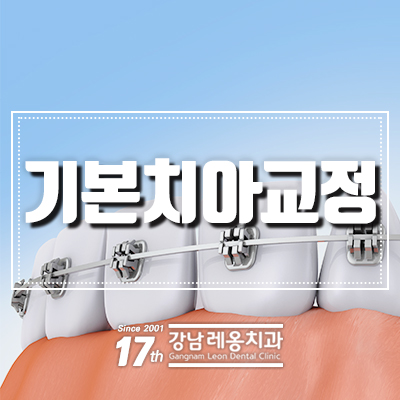 강남 치아교정치과 검증된 방법으로 만족도 업!! 관련 이미지 6