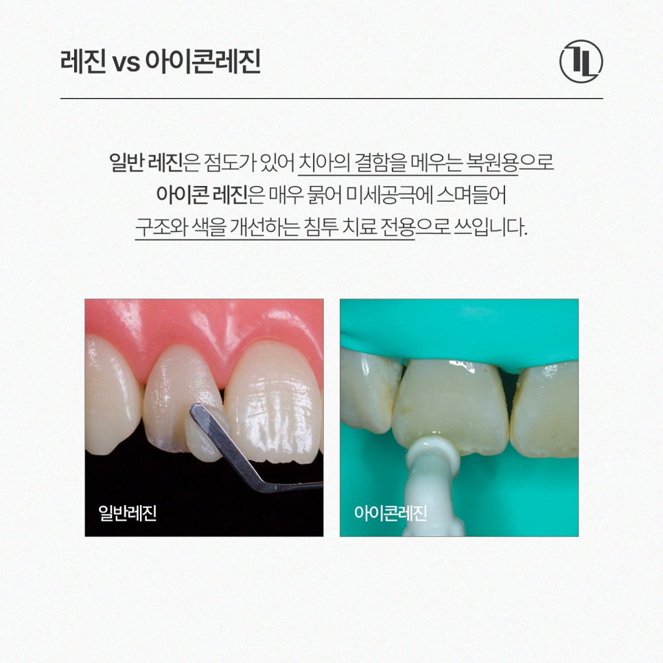 Must Check Before Treating White Spots / Icon Resin Features, Process, and Precautions / Gangnam Leen Dental Clinic image 3