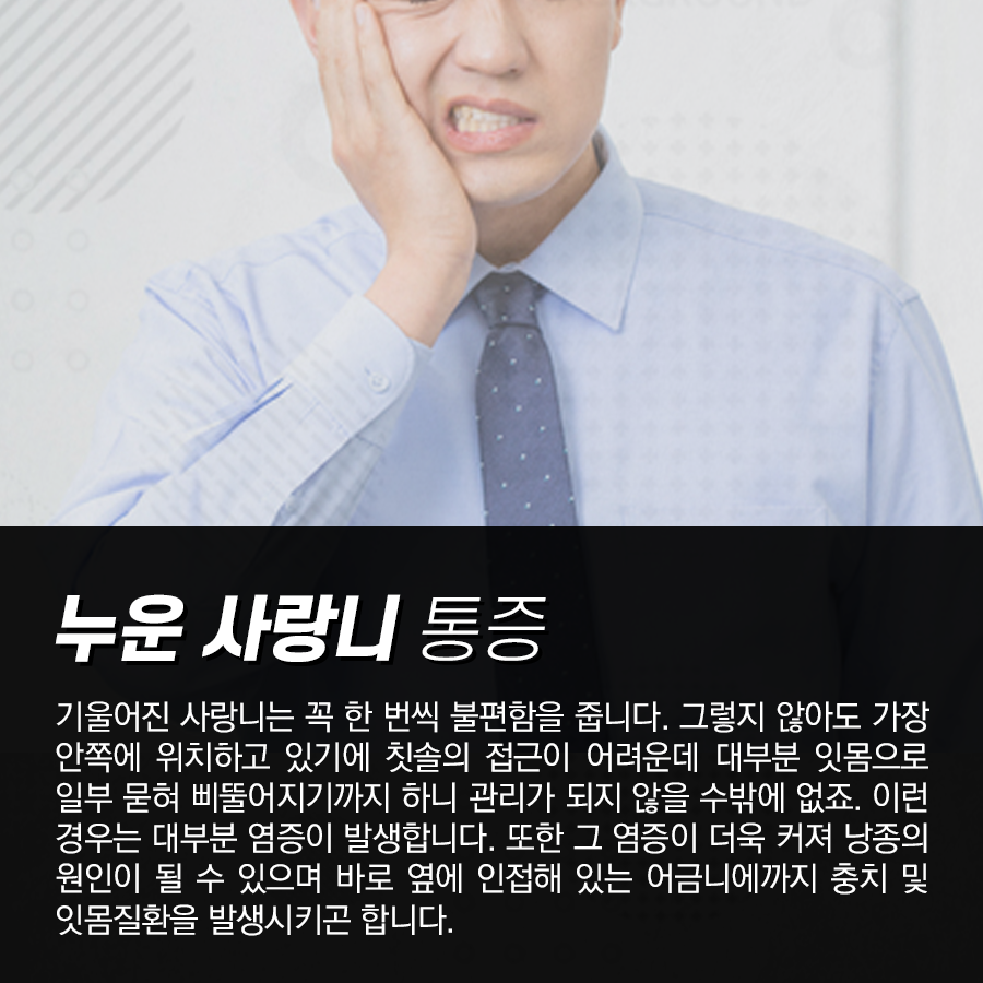 매복 된 누운 사랑니 발치를 하면 통증이 더 심할까? 관련 이미지 2
