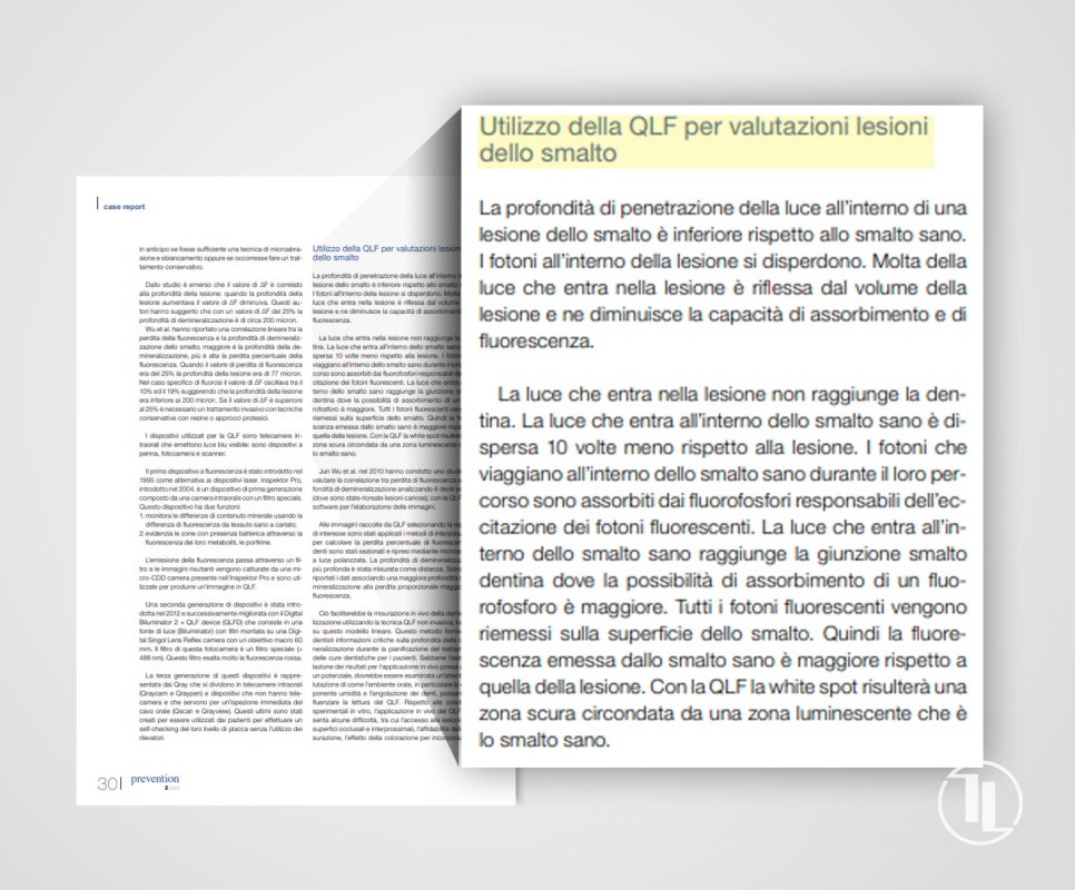 에나멜 손상 진단 및 치료에 사용되는 관련 이미지 2
