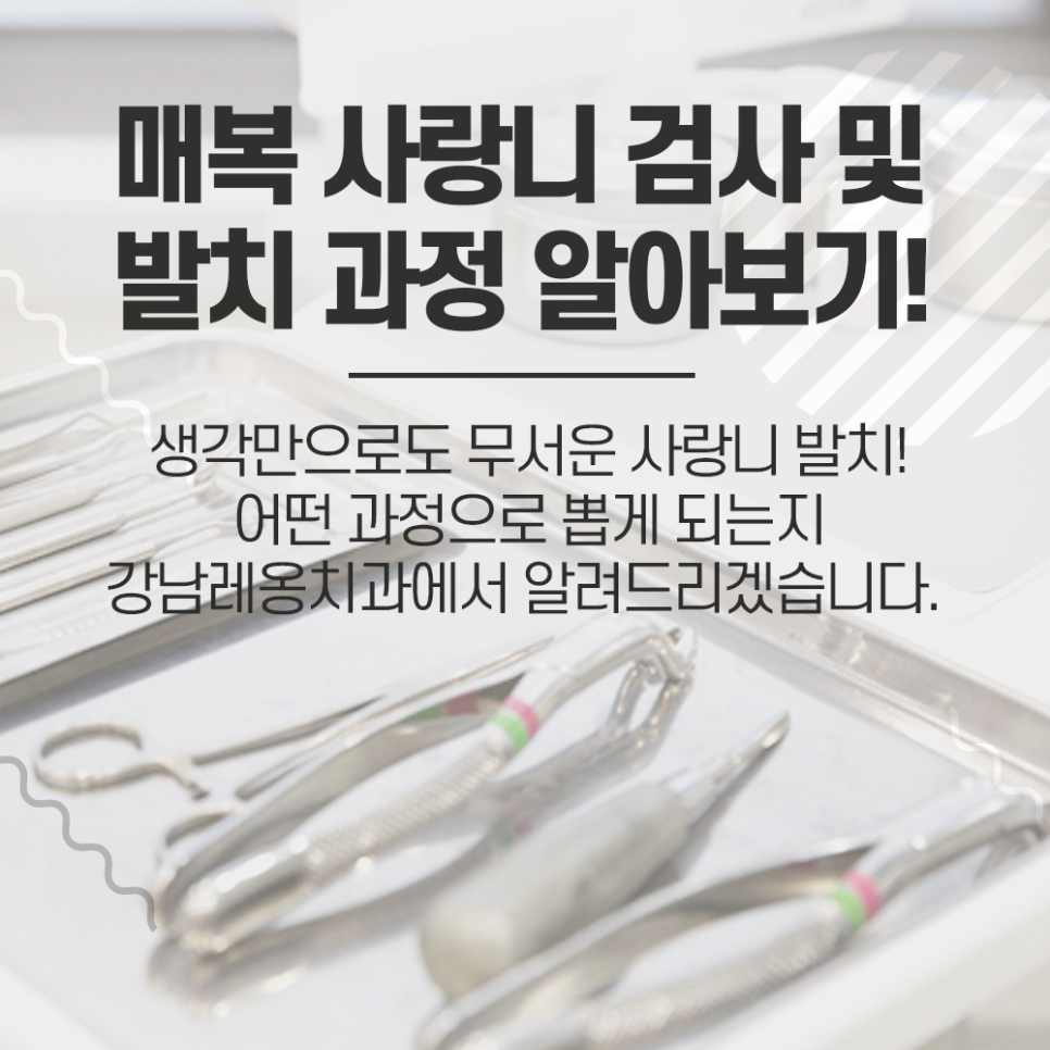 누운 사랑니 발치 과정, 매복 된 상태라면 검사 후 이런 순서로 뽑아요 관련 이미지 1