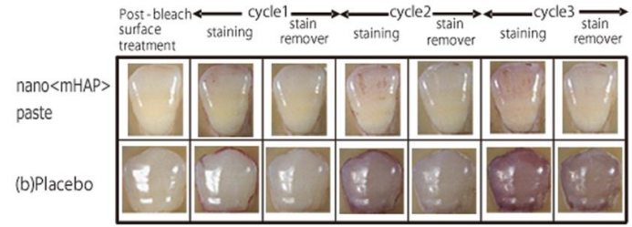 충치예방부터 시린이 완화까지! 아파프로 치아영양제의 5가지 효과✨ / 강남레옹치과 관련 이미지 8