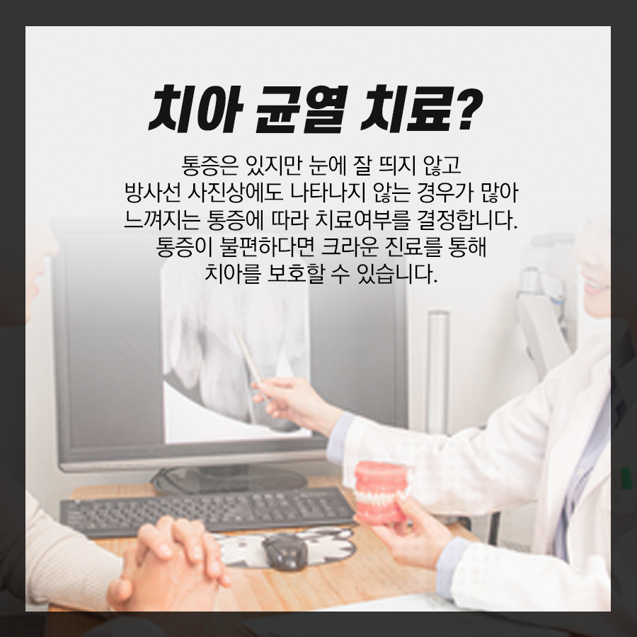 치아크랙? 치아에 금이 가는 이유, 균열 생겼을 때 증상 관련 이미지 5
