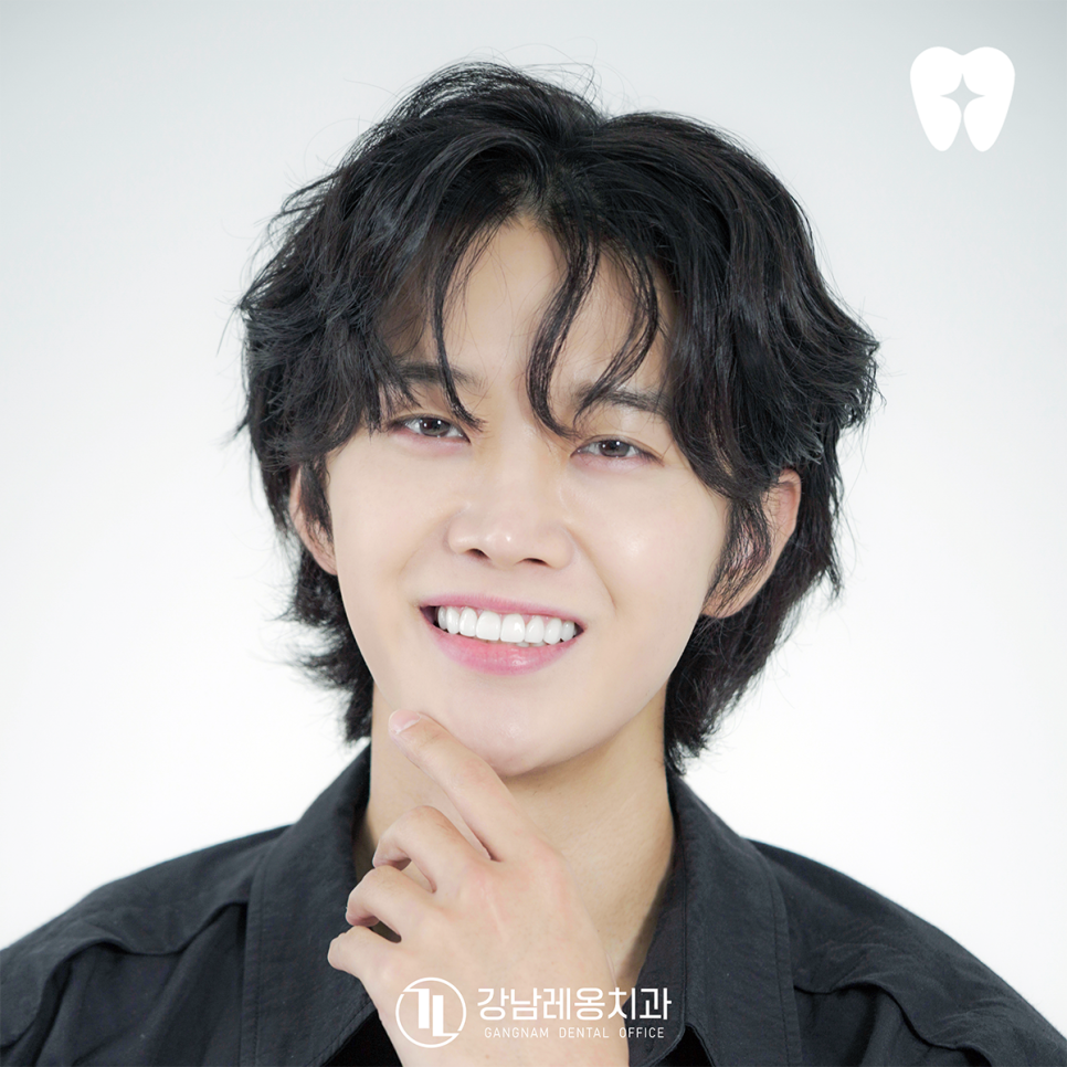 Complete a Brighter Smile in Front of the Camera! Actor Park Hyun’s NewTeeth Laminates image 3