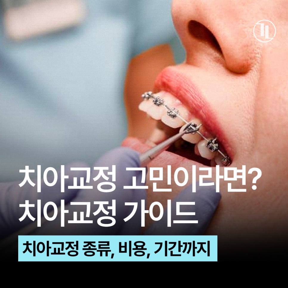 치아교정 현실 가이드 / 치아교정 종류, 비용, 기간,  FAQ까지 / 강남레옹치과 관련 이미지 1