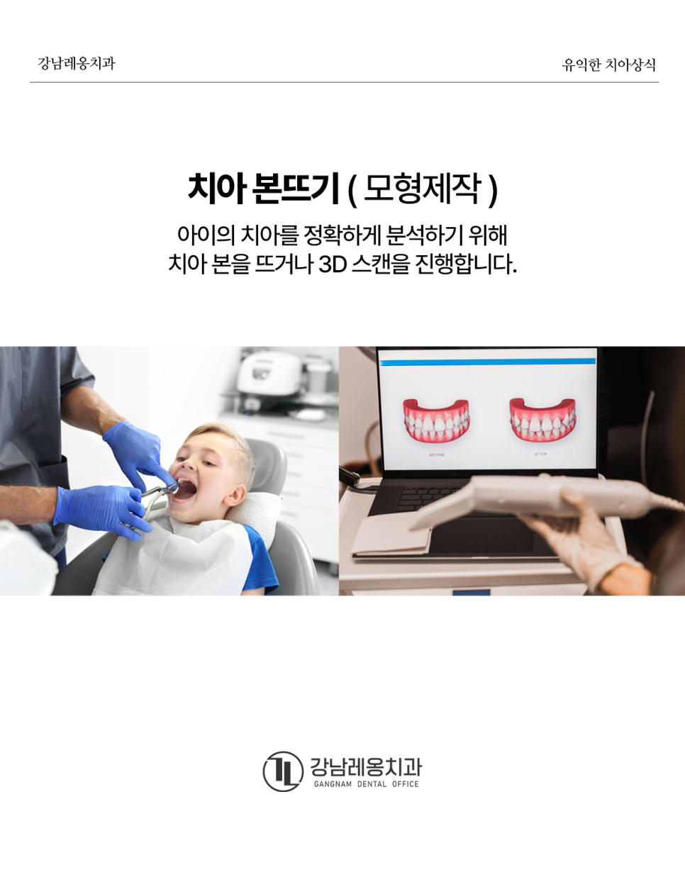 🦷 어린이 교정, 진단 및 상담은 어떻게 진행될까? / 강남레옹치과 관련 이미지 4