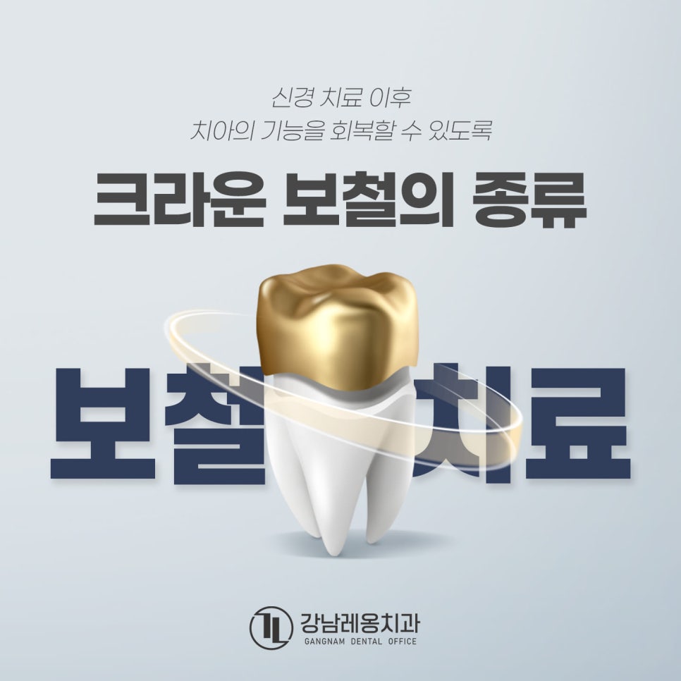 신경치료 후 남아 있는 자연치아 보호를 위한 &lsquo;크라운 치료&rsquo;의 종류와 특징은? 관련 이미지 1