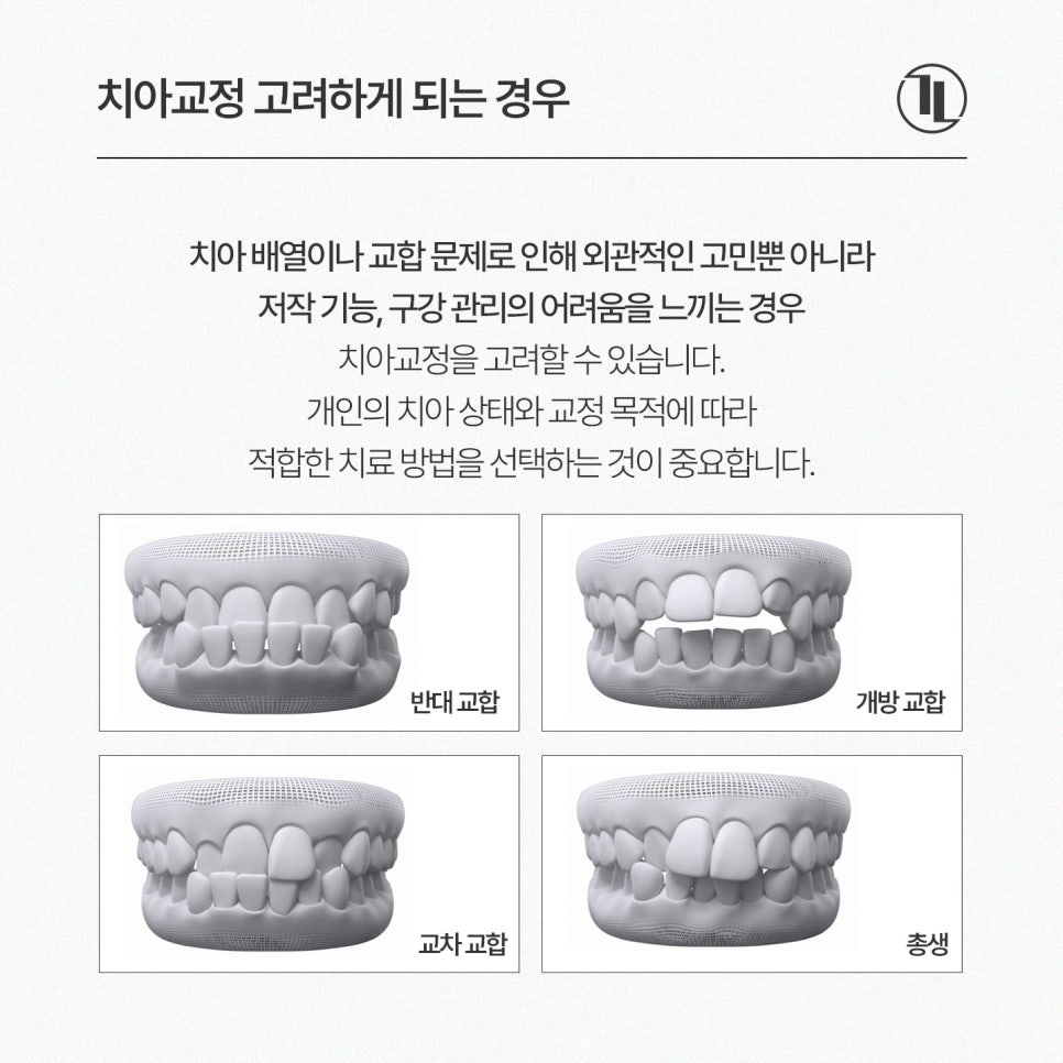 치아교정 현실 가이드 / 치아교정 종류, 비용, 기간,  FAQ까지 / 강남레옹치과 관련 이미지 2