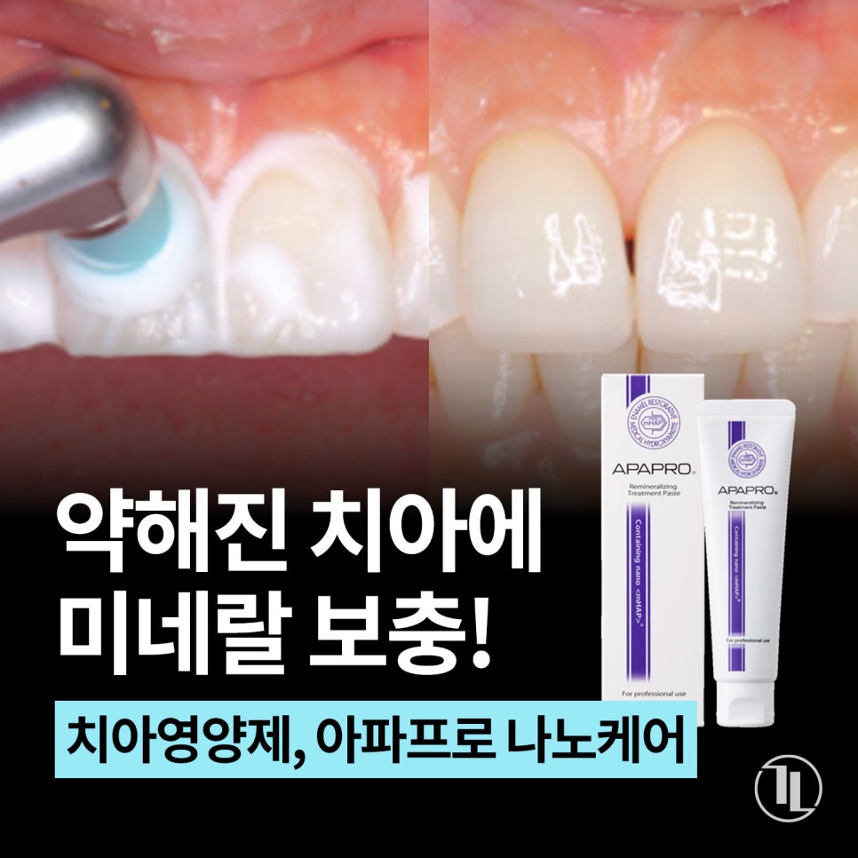 치아성분 치아영양제 아파프로로 약해진 치아관리! / 강남레옹치과 관련 이미지 1