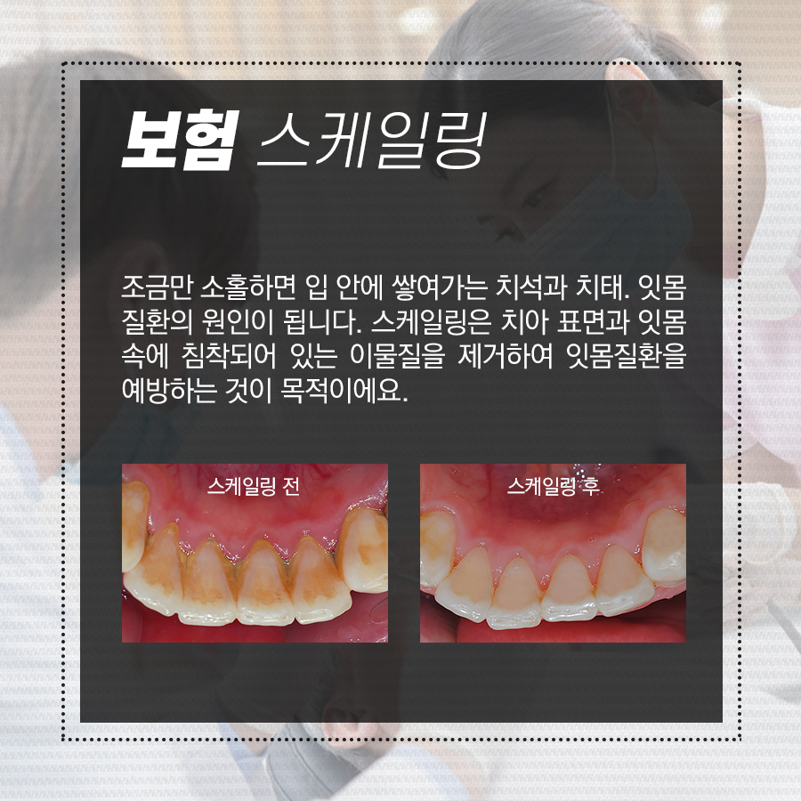 강남역 보험 스케일링, 잇몸치료!! 구강건강 지키는 꿀팁 관련 이미지 3