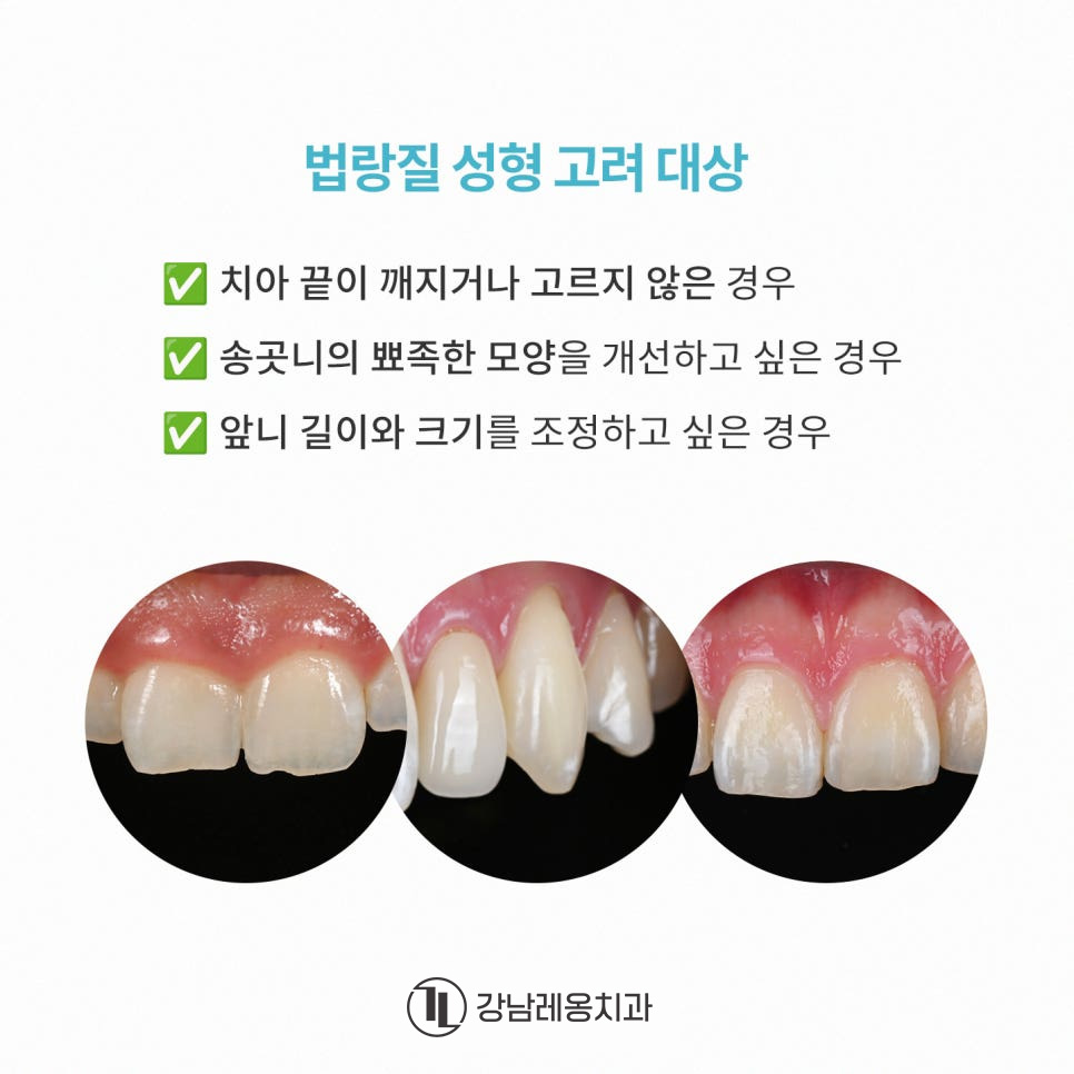 깨진 앞니 길이가 긴 앞니, 법랑질 성형 알아보기🔎 / 강남레옹치과의원 관련 이미지 2