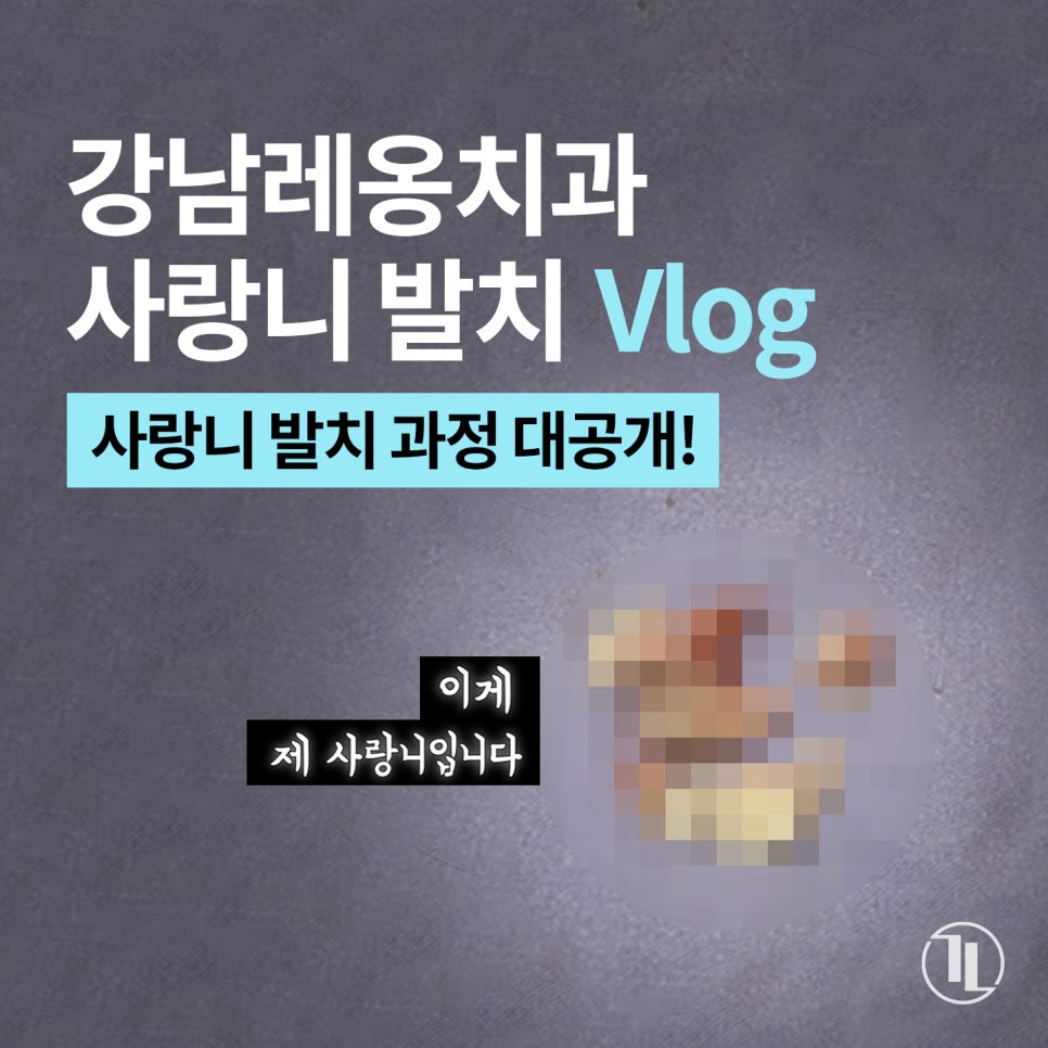 강남레옹치과 사랑니 발치 Vlog📽️ | 사랑니 발치 과정 대공개! 관련 이미지 1
