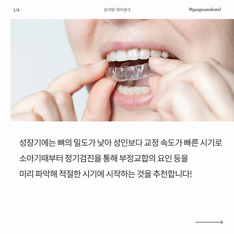 청소년 치아교정 관리의 중요성과 고정식 브라켓 교정&인비절라인 투명 치아 교정 양치하는 방법 관련 이미지 2