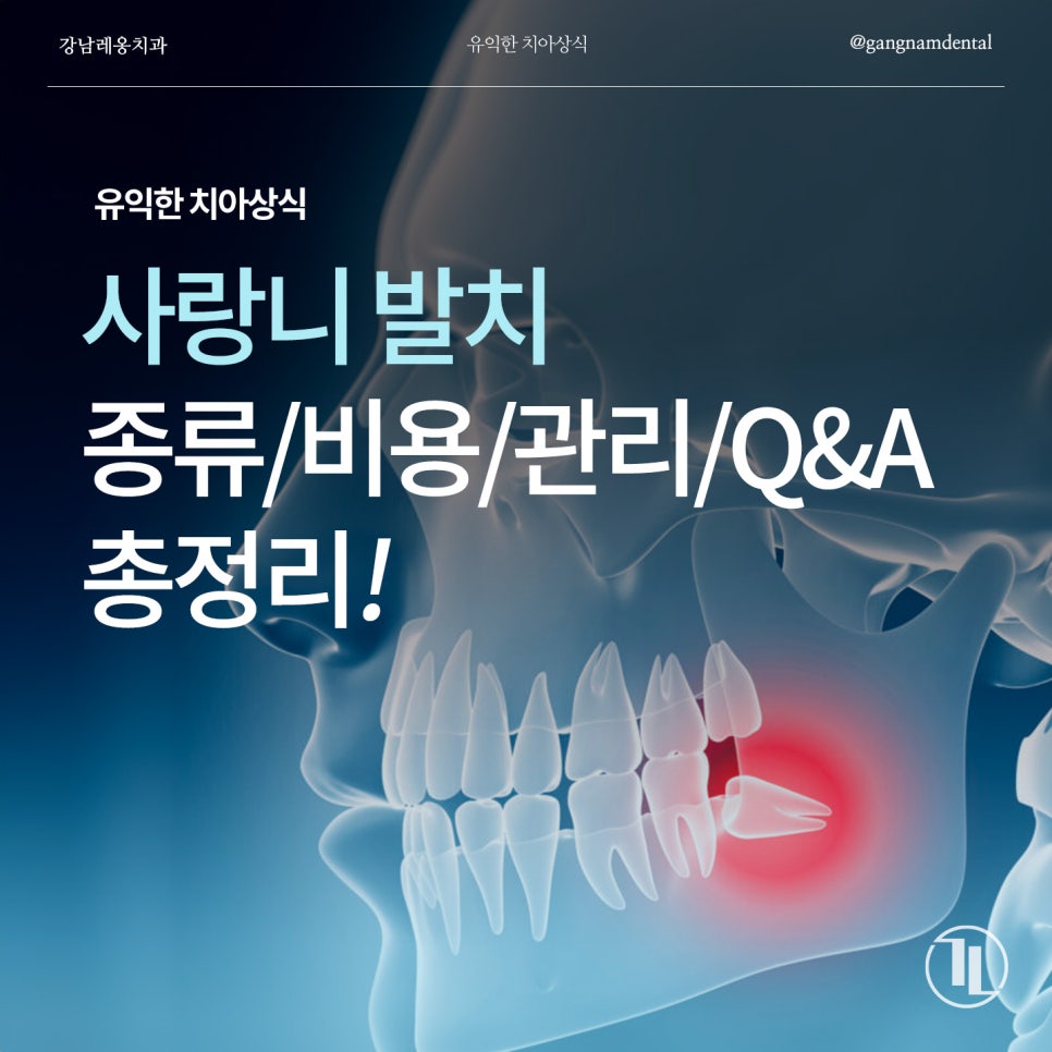 사랑니 발치에 대한 모든것, 사랑니 총정리! / 종류, 비용, 발치과정, 관리, Q&A까지! / 강남레옹치과 관련 이미지 1