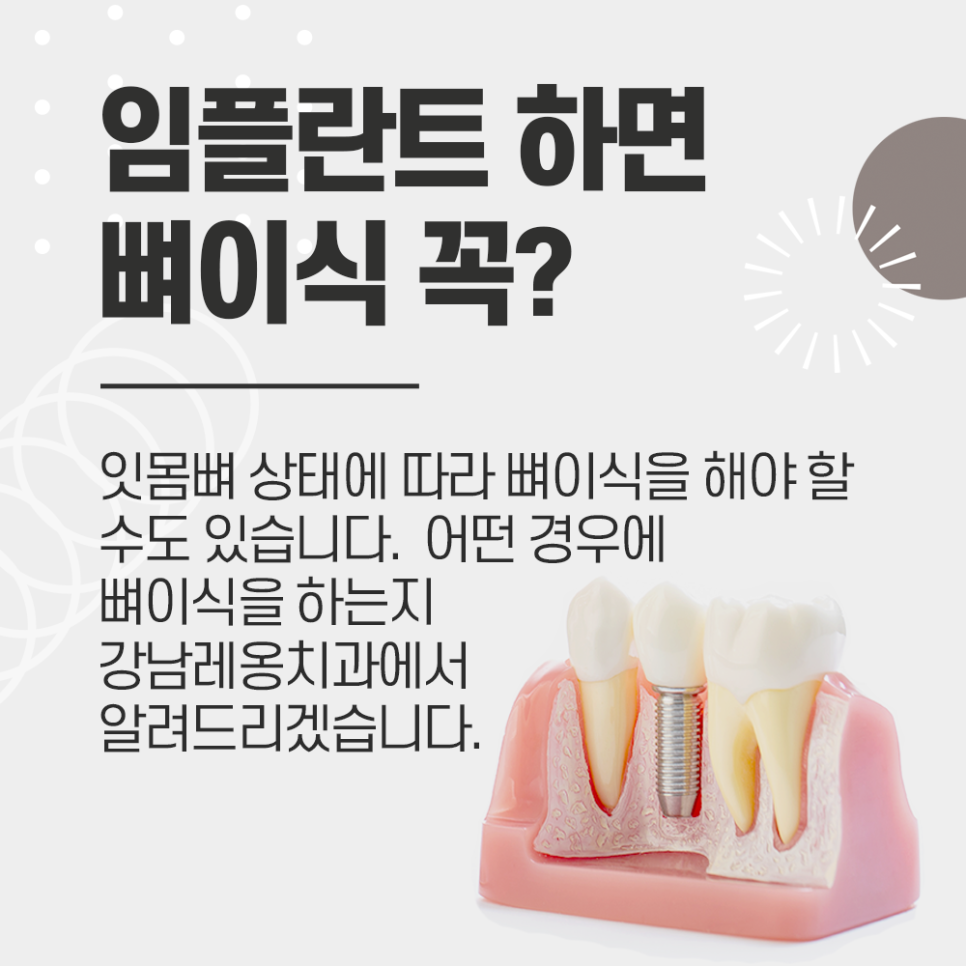 강남레옹치과 뼈이식 임플란트 수술, 어떤 경우에 해야 될까? 관련 이미지 1