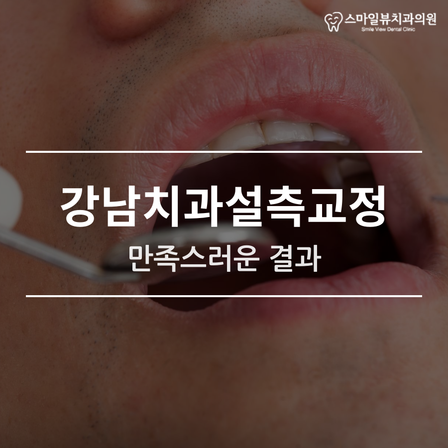 강남치과설측교정 만족스러운 결과 관련 이미지 1